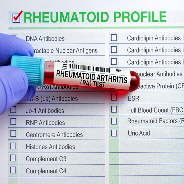 التحاليل الخاصة بالروماتويد